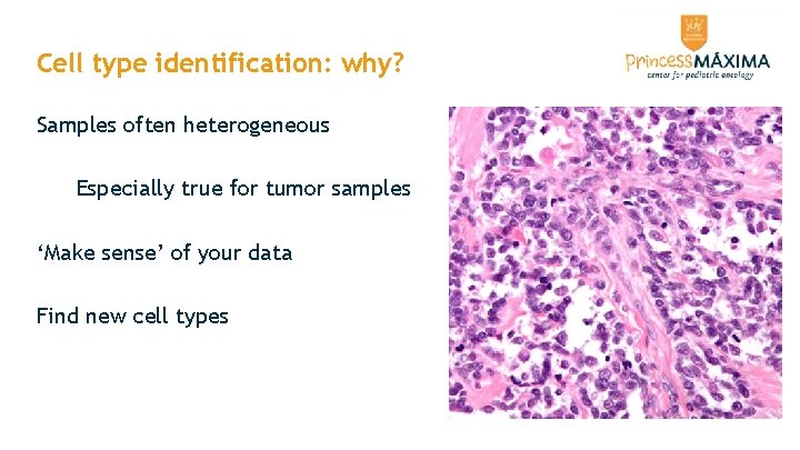 Cell type identification: why? Samples often heterogeneous Especially true for tumor samples ‘Make sense’ Cell type identification: why? Samples often heterogeneous Especially true for tumor samples ‘Make sense’