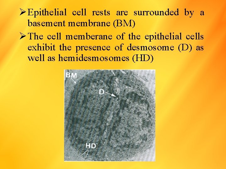 Ø Epithelial cell rests are surrounded by a basement membrane (BM) Ø The cell