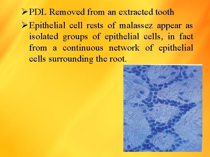 Ø PDL Removed from an extracted tooth Ø Epithelial cell rests of malassez appear