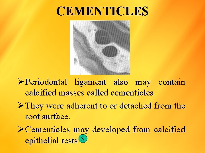 CEMENTICLES Ø Periodontal ligament also may contain calcified masses called cementicles Ø They were