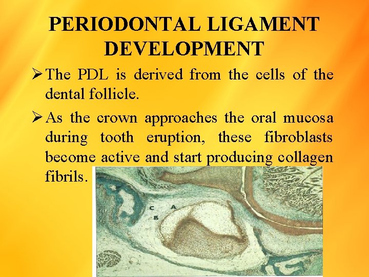 PERIODONTAL LIGAMENT DEVELOPMENT Ø The PDL is derived from the cells of the dental