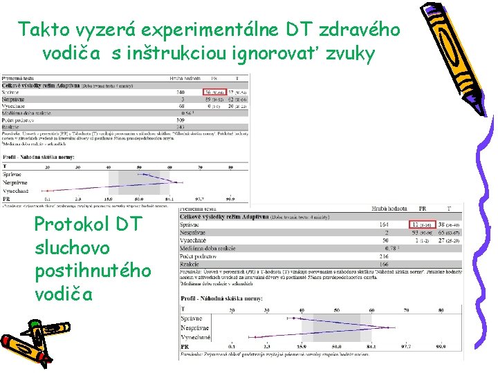 Takto vyzerá experimentálne DT zdravého vodiča s inštrukciou ignorovať zvuky Protokol DT sluchovo postihnutého