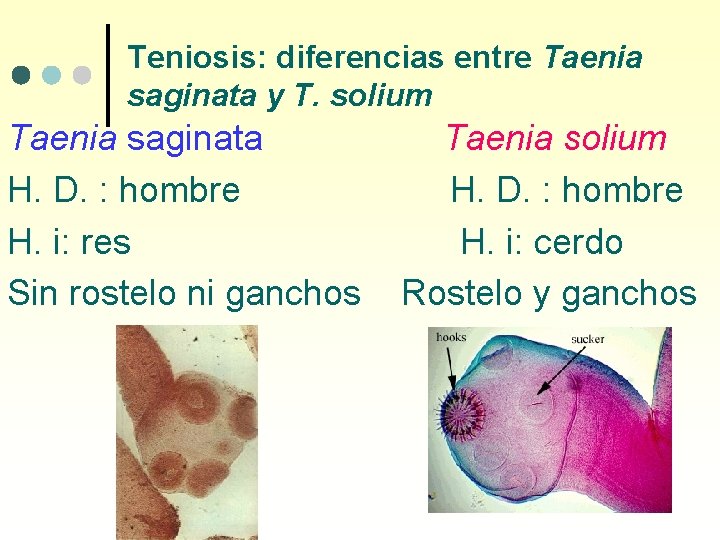 Teniosis: diferencias entre Taenia saginata y T. solium Taenia saginata H. D. : hombre