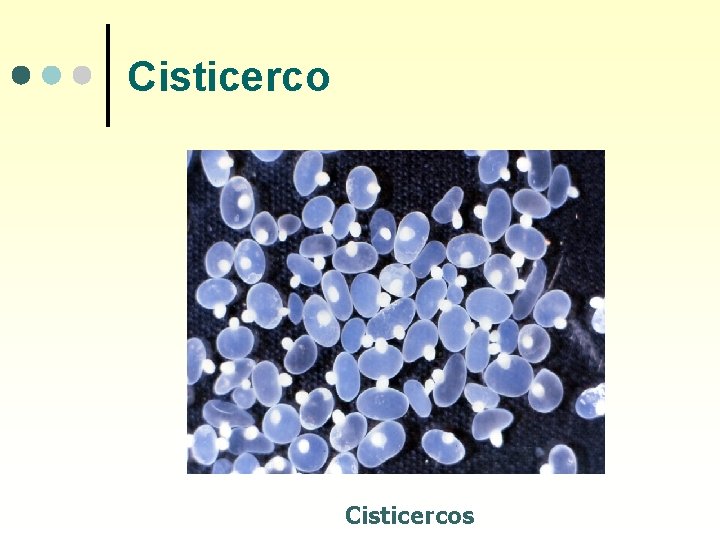 Cisticercos 