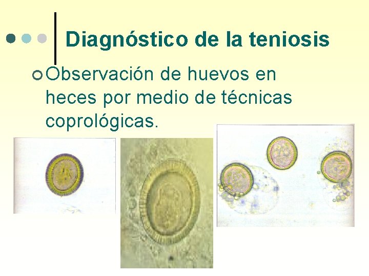 Diagnóstico de la teniosis ¢ Observación de huevos en heces por medio de técnicas