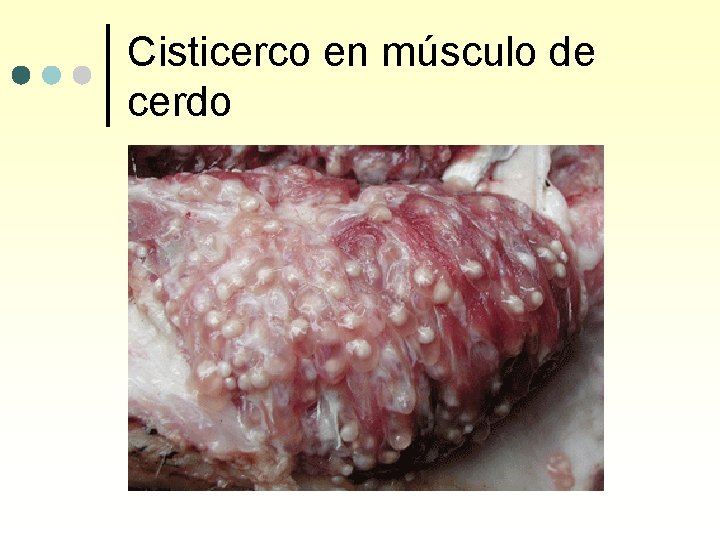 Cisticerco en músculo de cerdo 