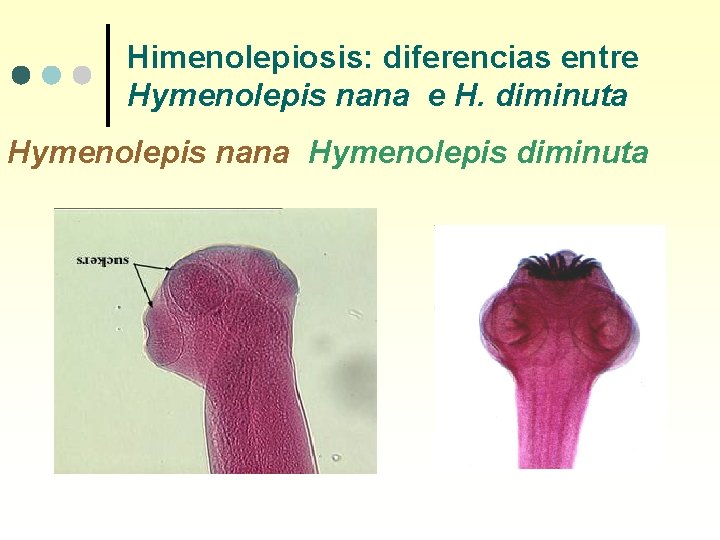 Himenolepiosis: diferencias entre Hymenolepis nana e H. diminuta Hymenolepis nana Hymenolepis diminuta 