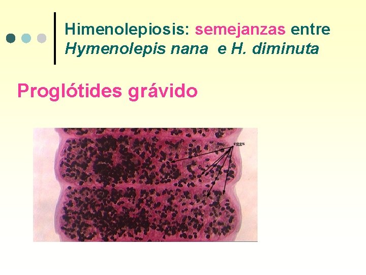 Himenolepiosis: semejanzas entre Hymenolepis nana e H. diminuta Proglótides grávido 