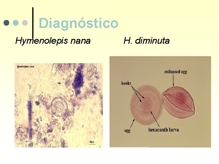 Diagnóstico Hymenolepis nana H. diminuta 