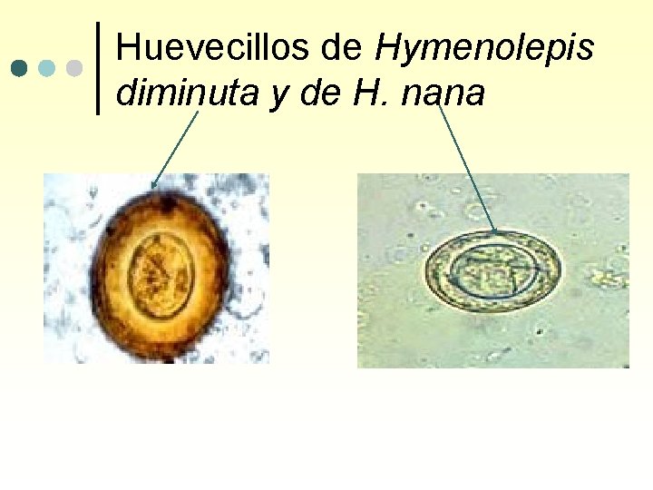 Huevecillos de Hymenolepis diminuta y de H. nana 