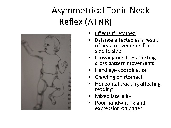 Asymmetrical Tonic Neak Reflex (ATNR) • Effects if retained • Balance affected as a