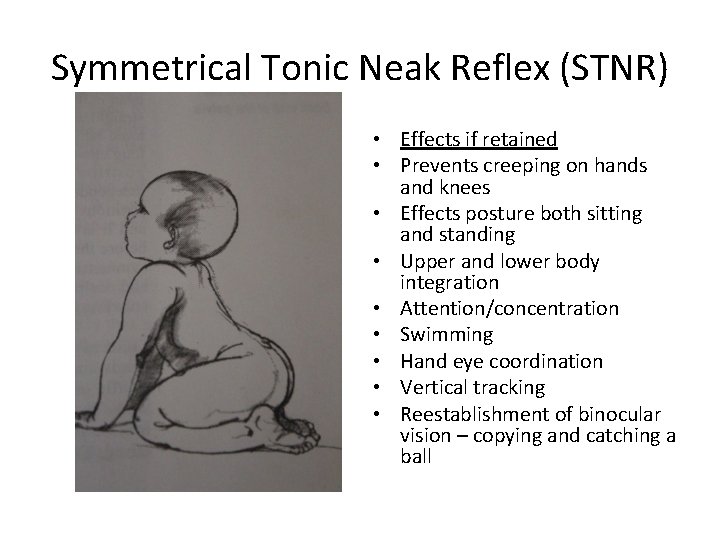Symmetrical Tonic Neak Reflex (STNR) • Effects if retained • Prevents creeping on hands