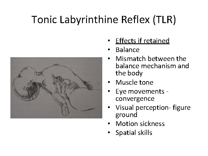 Tonic Labyrinthine Reflex (TLR) • Effects if retained • Balance • Mismatch between the