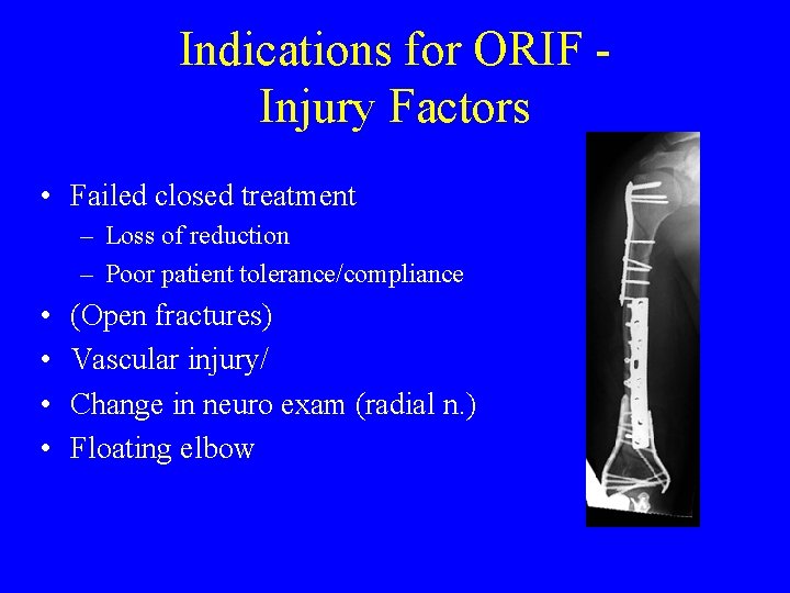 Indications for ORIF Injury Factors • Failed closed treatment – Loss of reduction –