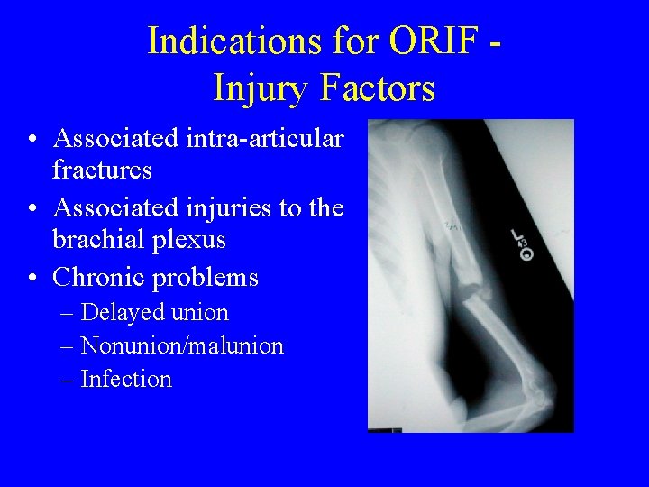 Indications for ORIF Injury Factors • Associated intra-articular fractures • Associated injuries to the