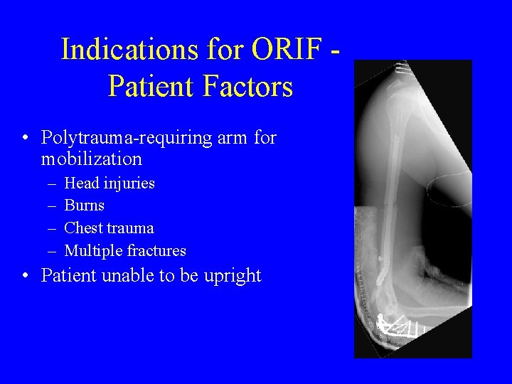 Indications for ORIF Patient Factors • Polytrauma-requiring arm for mobilization – – Head injuries