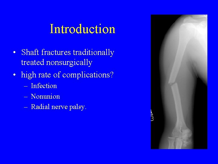 Introduction • Shaft fractures traditionally treated nonsurgically • high rate of complications? – Infection