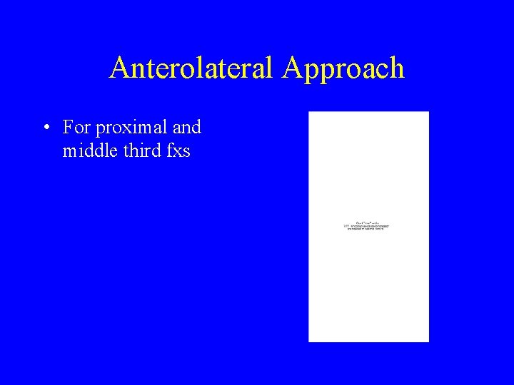 Anterolateral Approach • For proximal and middle third fxs 