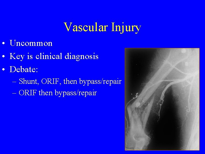 Vascular Injury • Uncommon • Key is clinical diagnosis • Debate: – Shunt, ORIF,