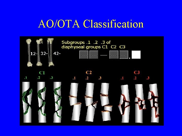 AO/OTA Classification 