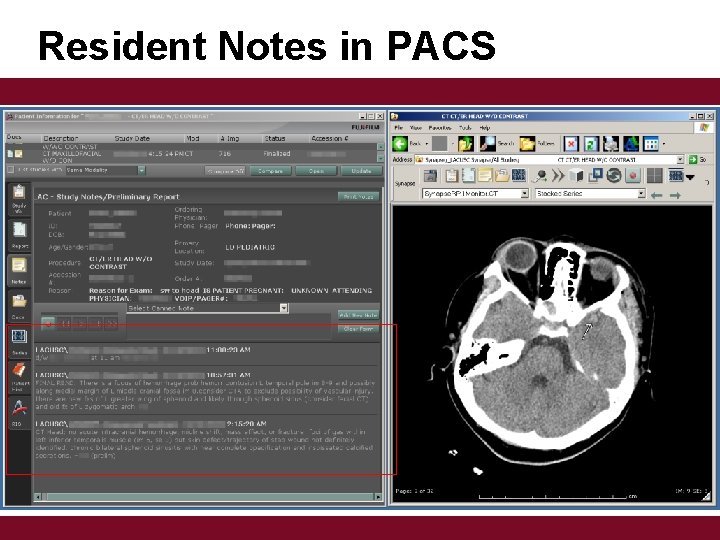 Resident Notes in PACS 