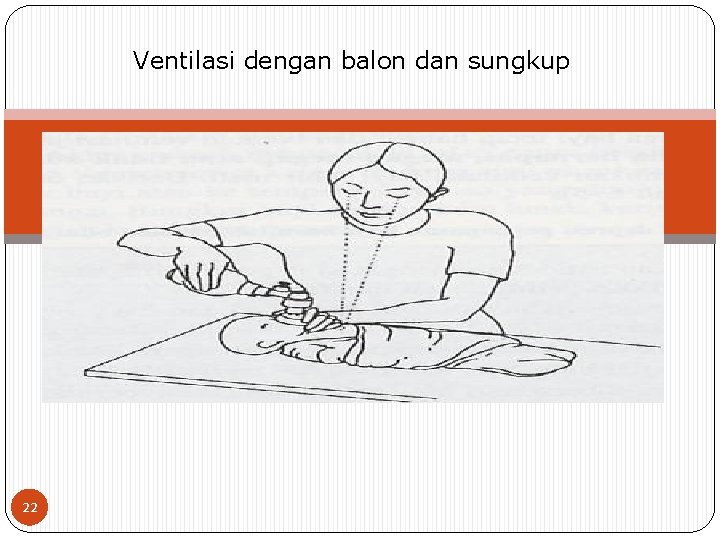 Ventilasi dengan balon dan sungkup 22 