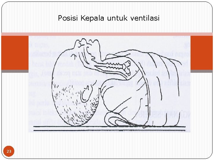 Posisi Kepala untuk ventilasi 23 