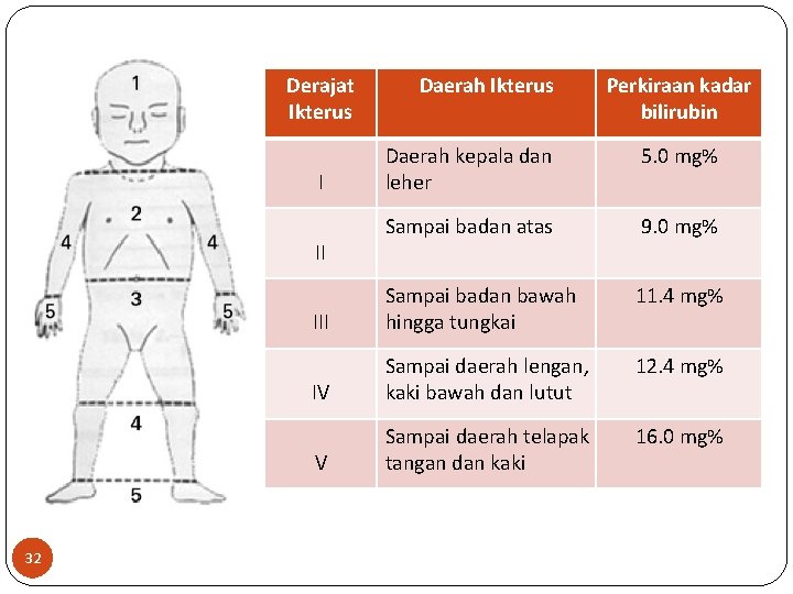 Derajat Ikterus Perkiraan kadar bilirubin Daerah kepala dan leher 5. 0 mg% Sampai badan