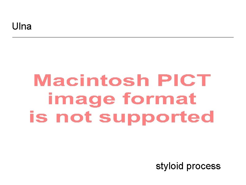 Ulna styloid process 