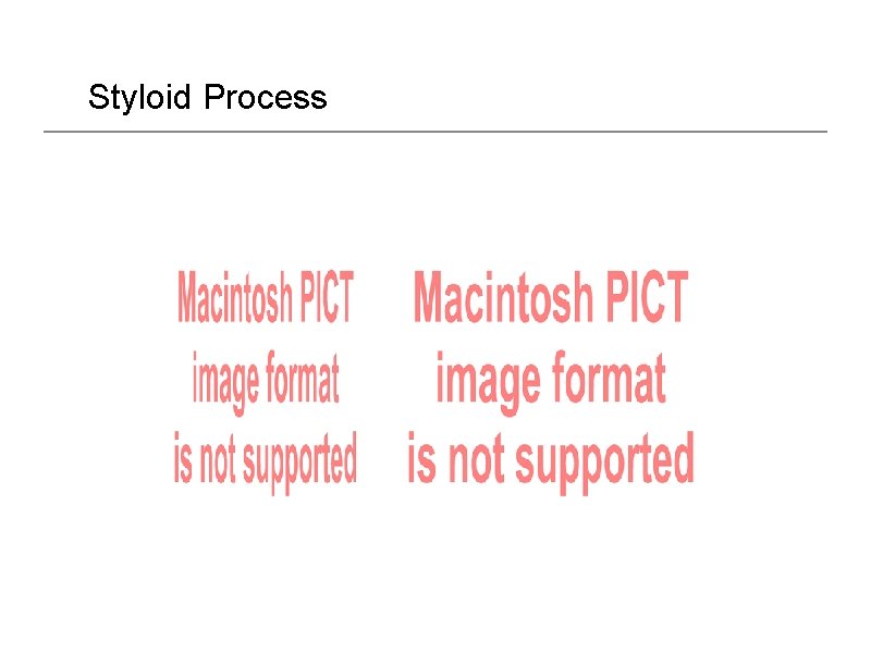 Styloid Process 