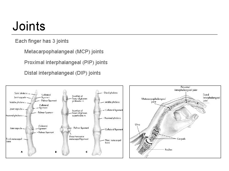 Joints • Each finger has 3 joints – Metacarpophalangeal (MCP) joints – Proximal interphalangeal