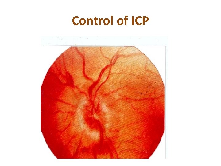 Control of ICP 