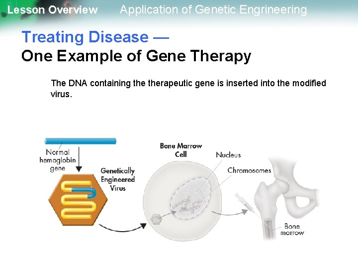 Lesson Overview Application of Genetic Engrineering Treating Disease — One Example of Gene Therapy