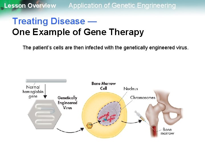 Lesson Overview Application of Genetic Engrineering Treating Disease — One Example of Gene Therapy