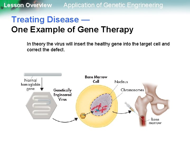 Lesson Overview Application of Genetic Engrineering Treating Disease — One Example of Gene Therapy