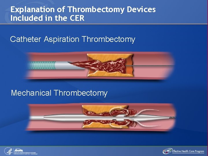 Explanation of Thrombectomy Devices Included in the CER Catheter Aspiration Thrombectomy Mechanical Thrombectomy 