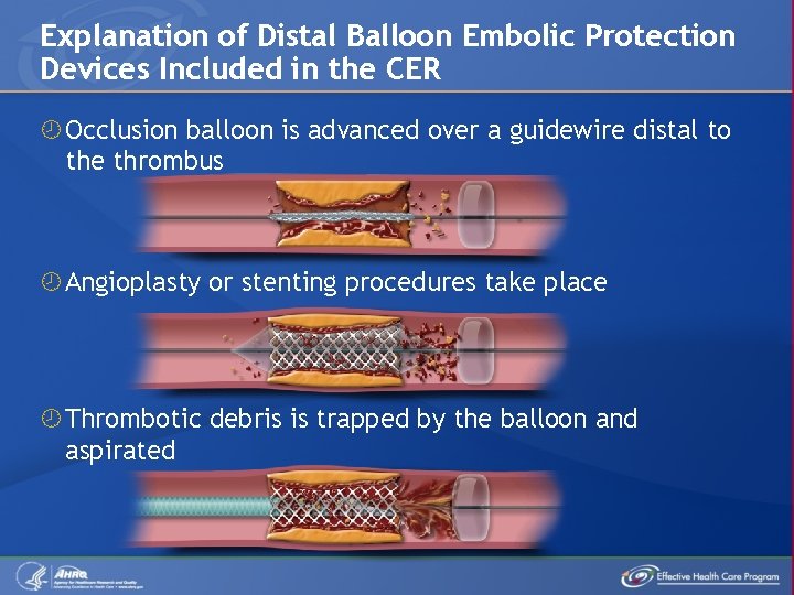 Explanation of Distal Balloon Embolic Protection Devices Included in the CER Occlusion balloon is