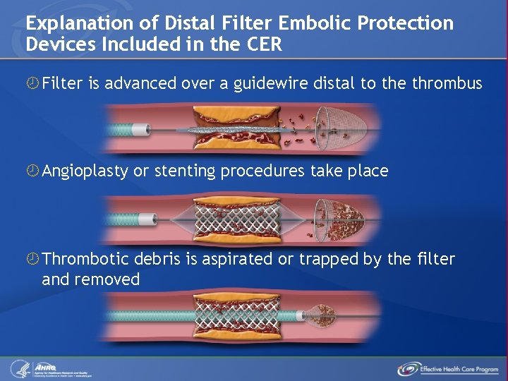 Explanation of Distal Filter Embolic Protection Devices Included in the CER Filter is advanced
