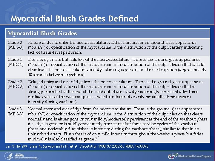 Myocardial Blush Grades Defined Myocardial Blush Grades Grade 0 (MBG-0) Failure of dye to