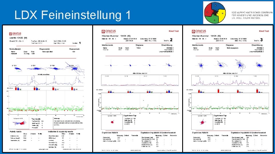 LDX Feineinstellung 1 LDX Feineinstellung 1