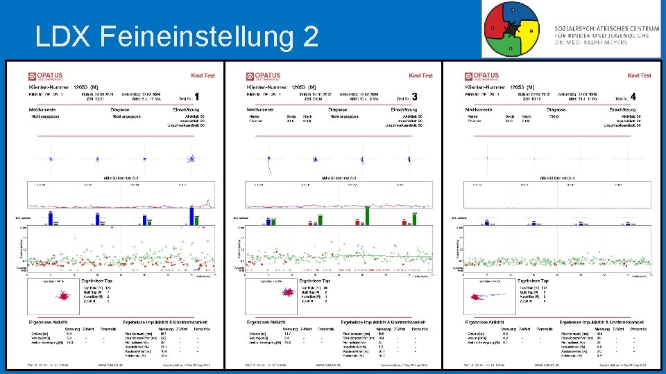 LDX Feineinstellung 2 LDX Feineinstellung 2