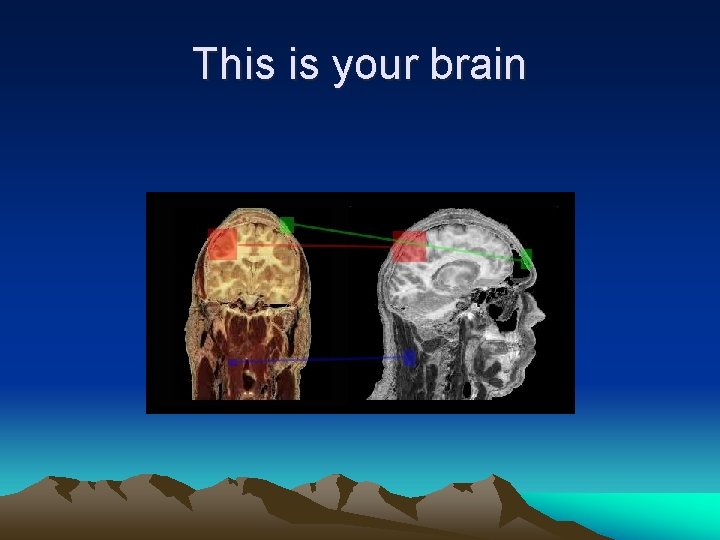 This is your brain This is your brain