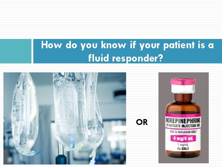 How do you know if your patient is a fluid responder? OR 