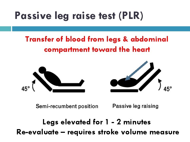 Passive leg raise test (PLR) Transfer of blood from legs & abdominal compartment toward