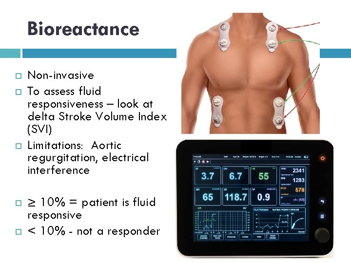 Bioreactance Non-invasive To assess fluid responsiveness – look at delta Stroke Volume Index (SVI)
