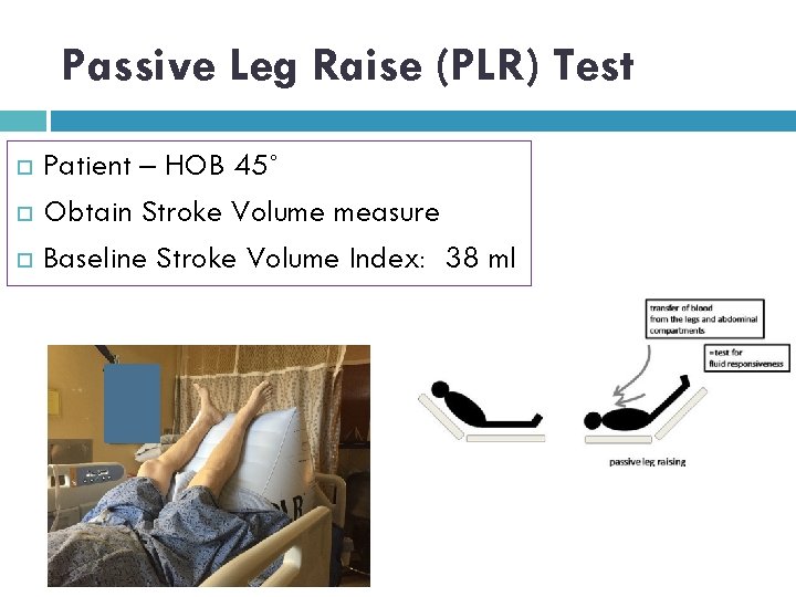 Passive Leg Raise (PLR) Test Patient – HOB 45˚ Obtain Stroke Volume measure Baseline