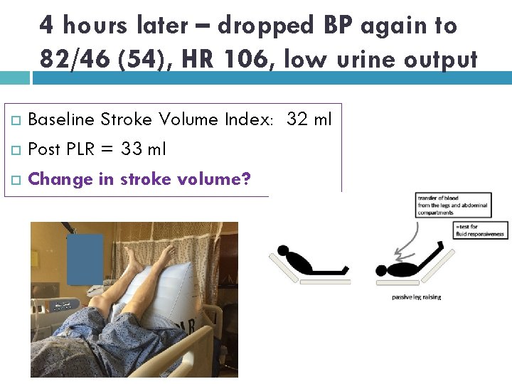 4 hours later – dropped BP again to 82/46 (54), HR 106, low urine