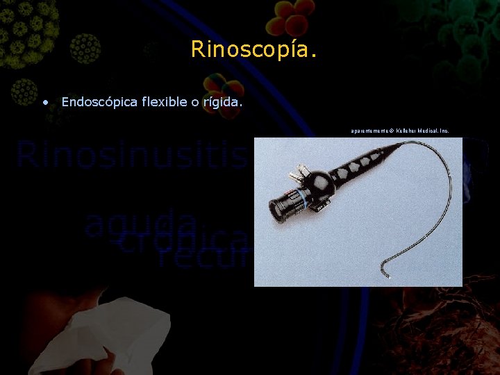 Rinoscopía. • Endoscópica flexible o rígida. aparentemente © Kelleher Medical, Inc. 