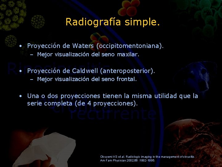 Radiografía simple. • Proyección de Waters (occipitomentoniana). – Mejor visualización del seno maxilar. •