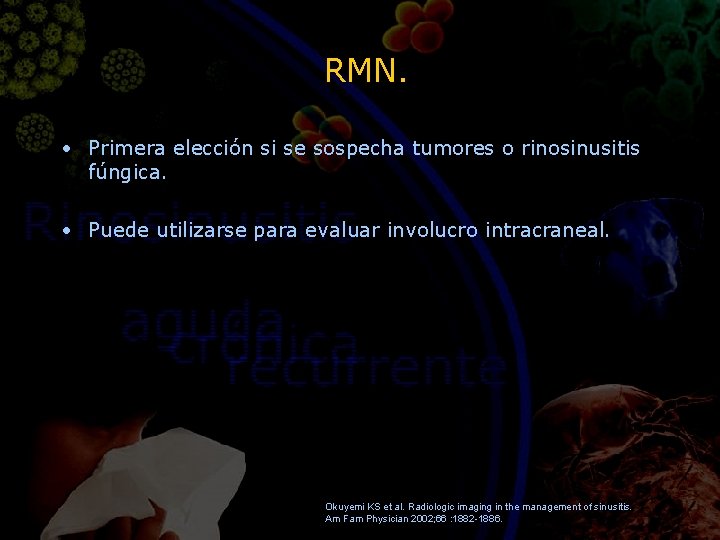 RMN. • Primera elección si se sospecha tumores o rinosinusitis fúngica. • Puede utilizarse